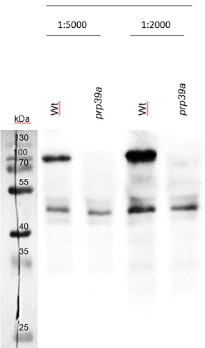 western blot using antiPRP39a antibodies